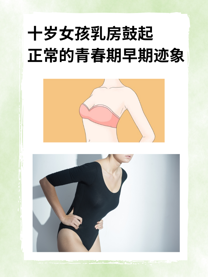 十岁女孩乳房鼓起：正常的青春期早期迹象