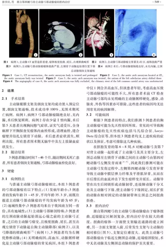 首次诊断并治疗一种新的疾病——源自第四鳃弓的主动脉弓部动脉瘤的腔内治疗