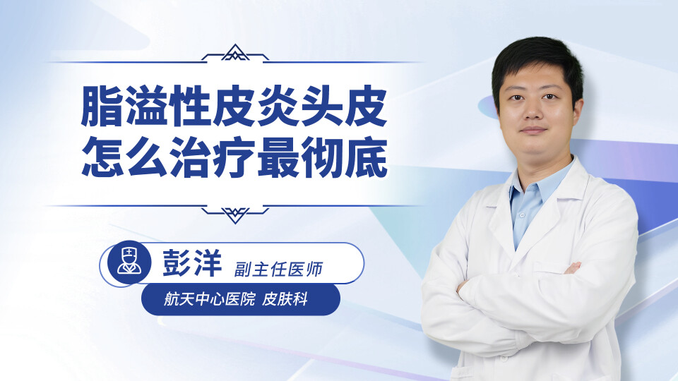 脂溢性皮炎头皮怎么治疗最彻底