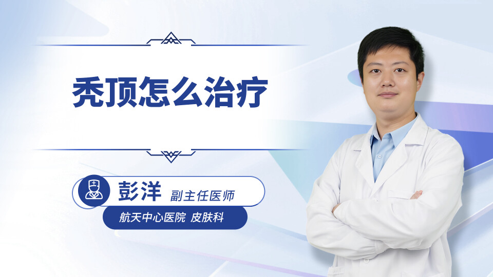 秃顶怎么治疗