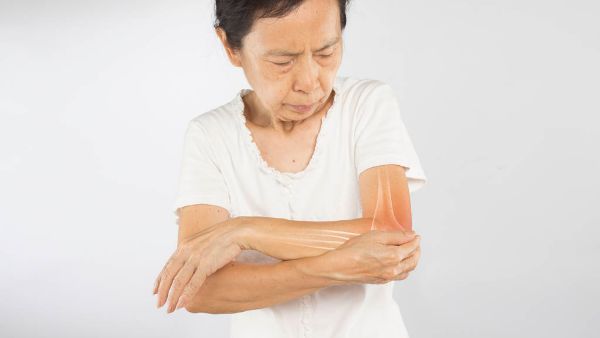 胳膊筋膜拉伤有什么症状
