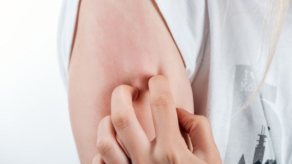 皮肤瘙痒挠破后结痂又痒怎么办​