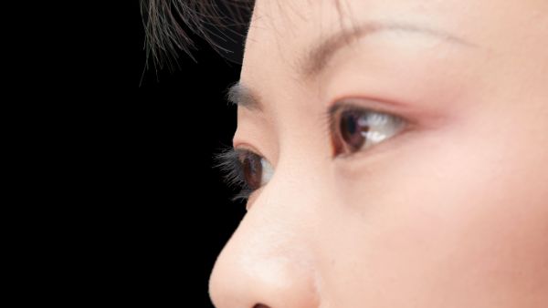 眼皮厚是什么原因