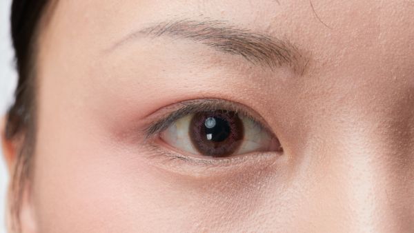 眼睛黄斑病变早期症状​
