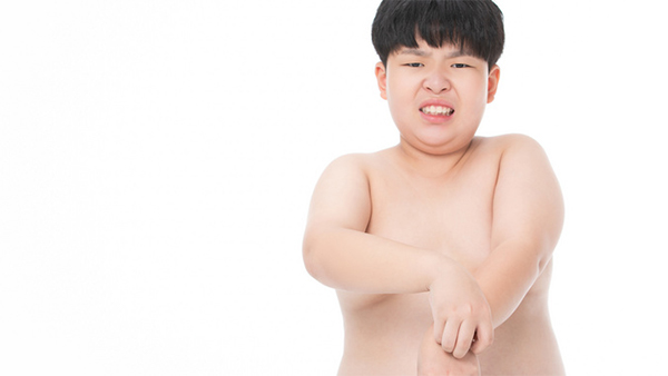 孩子身上痒一挠就红一片怎么回事，怎么办