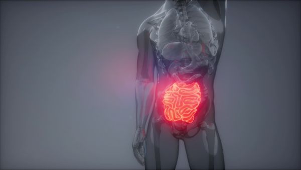 增生性肠息肉伴淋巴组织增生是怎么回事