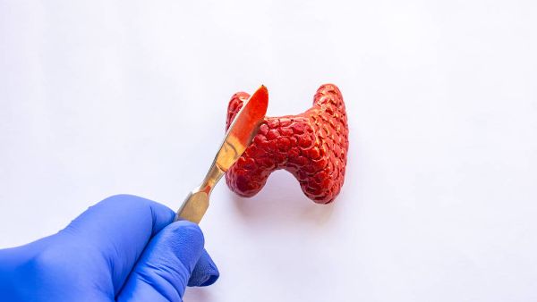 甲状腺癌全切的方法是什么