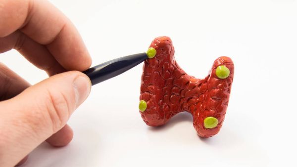 甲状腺舌骨囊肿有什么表现