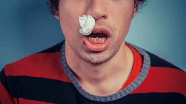 10秒止鼻血小妙招有哪些