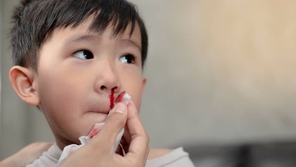 小孩子经常流鼻血是什么原因