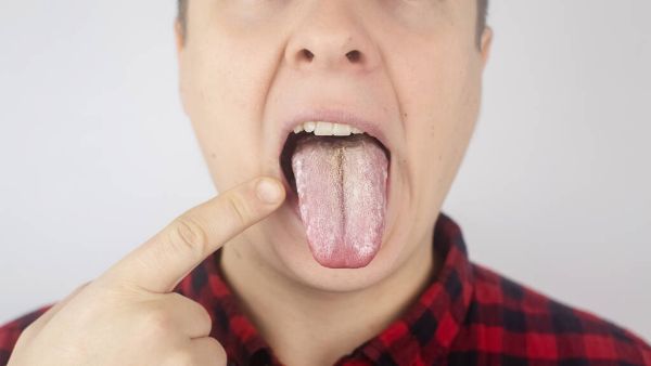 舌头烂是什么原因引起