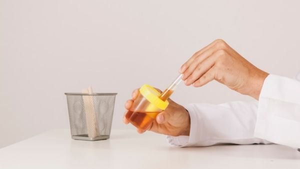 淀粉酶高多少要警惕