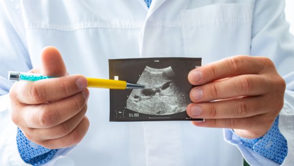 胆囊内强回声8mm怎么回事，怎么办