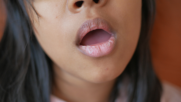 儿童抽动症的病因、症状
