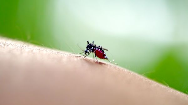 被蚊子咬后肿成大包怎么办