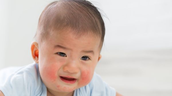 幼儿急疹的临床症状有哪些