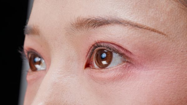眼睛视物变形是什么原因​