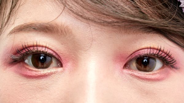盘点治疗眼睛飞蚊症的方法