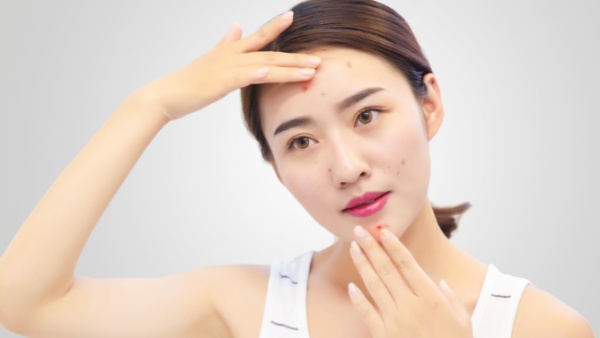 脸红长痘痘的原因是什么