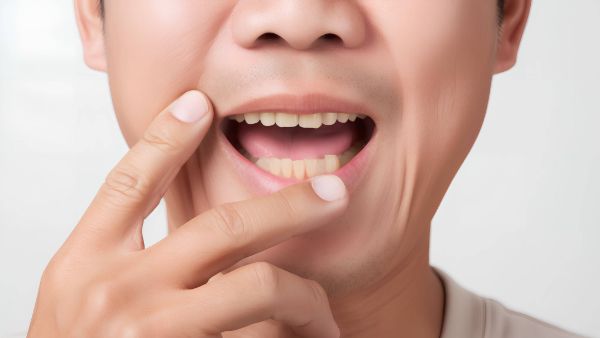 口腔感染hpv有什么症状