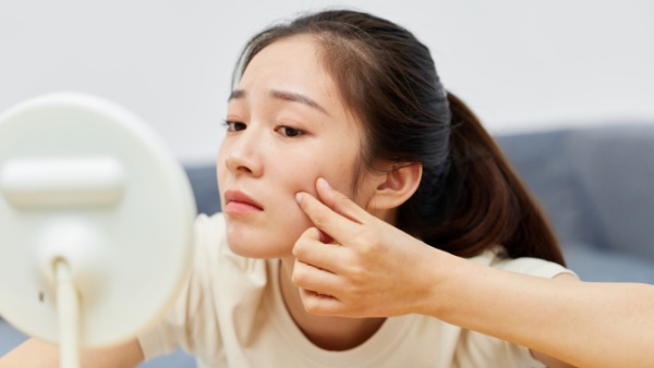 面部三角区反复长痘痘的情况是什么