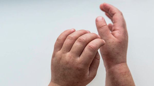 6岁孩子突然说手握不紧拳头是怎么回事
