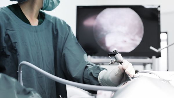 腹腔镜卵巢囊肿手术注意事项