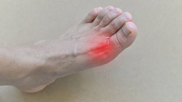 脚趾关节疼痛怎么办