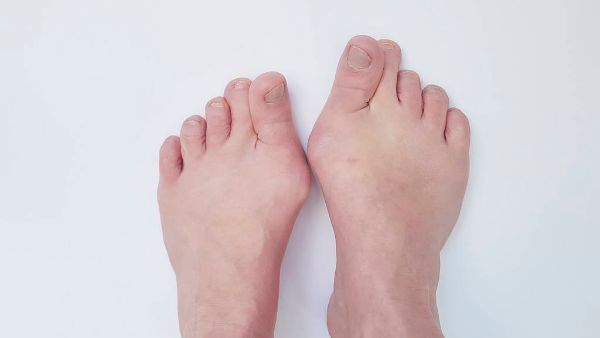 脚趾头抽筋如何处理
