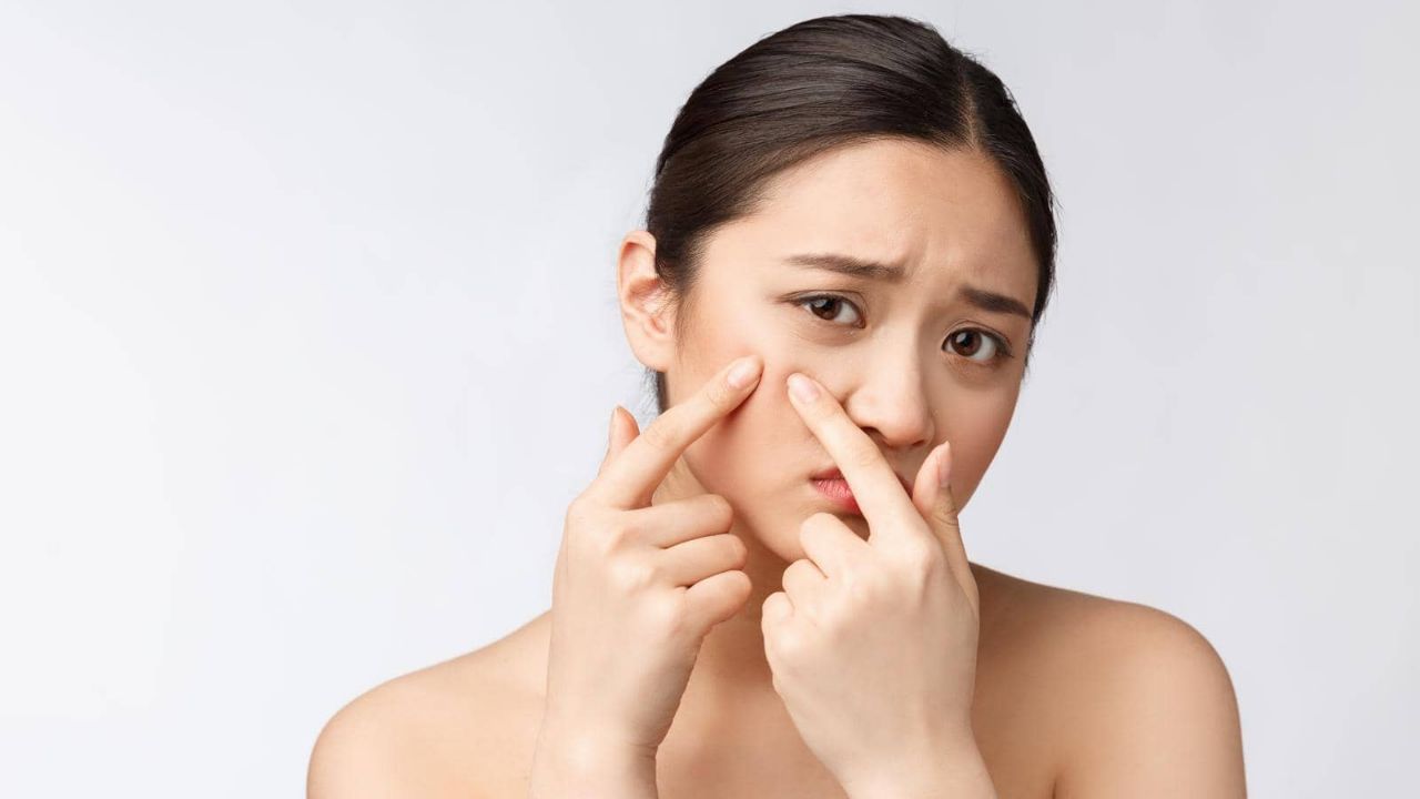 面部黄褐斑如何去除