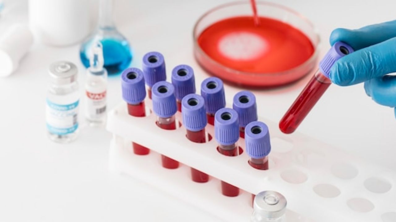 HIV的数值与病毒有关吗