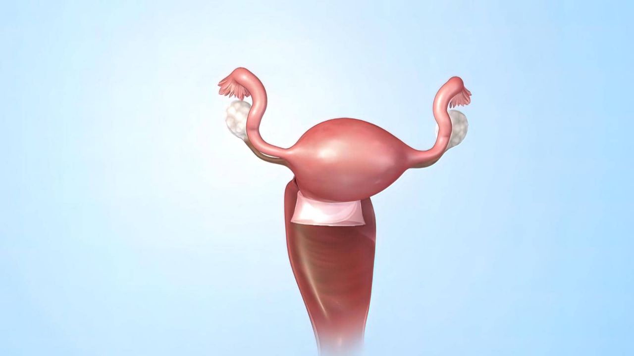子宫腺肌病该如何治疗