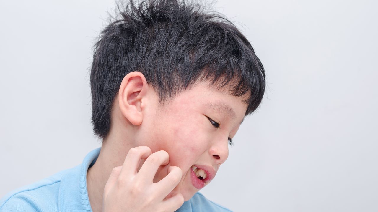孩子皮肤过敏破皮怎么办