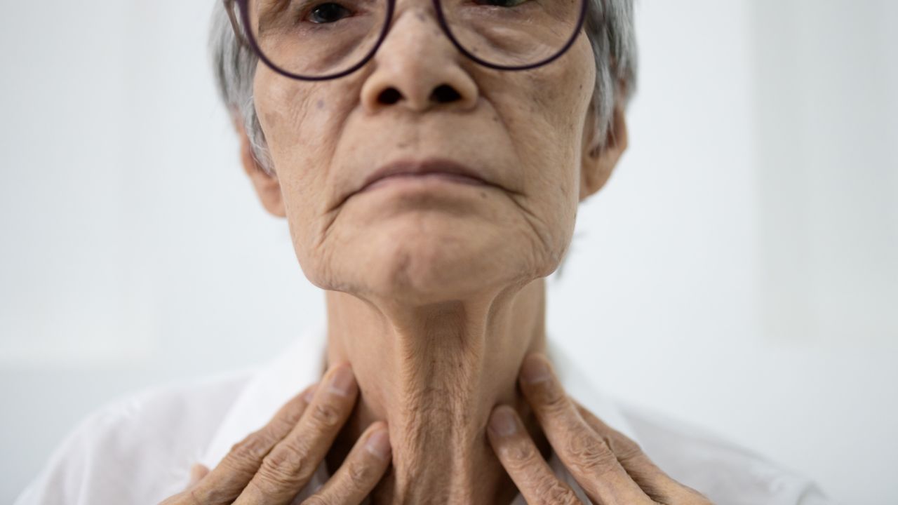 甲状腺甲减有什么症状
