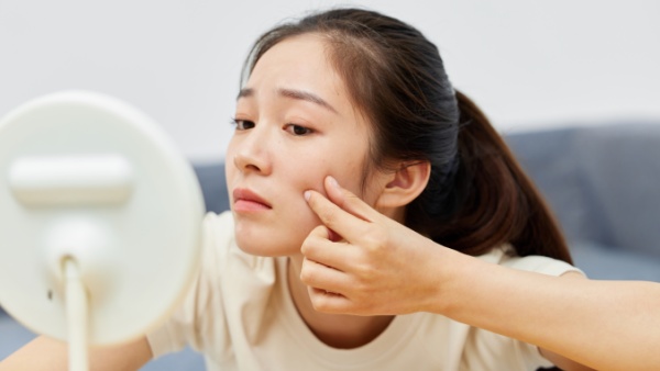脸上长痘痘的原因是什么