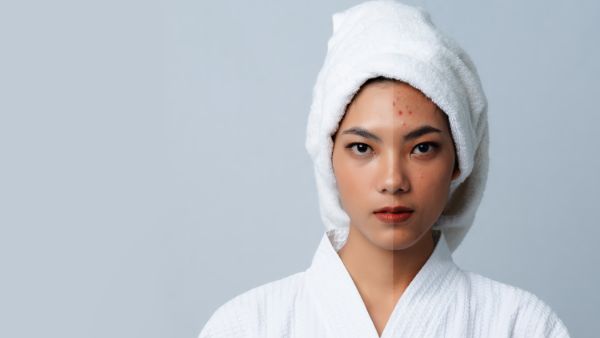 皮肤淀粉样变是什么原因​