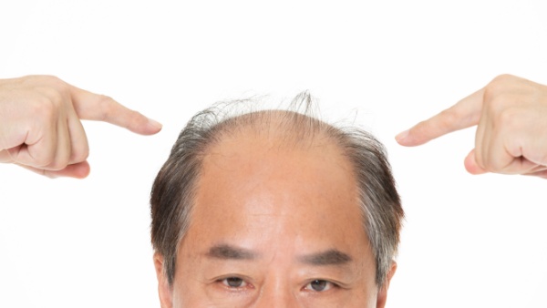 斑秃长出白毛是好转吗