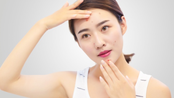 人中长痘痘是什么原因