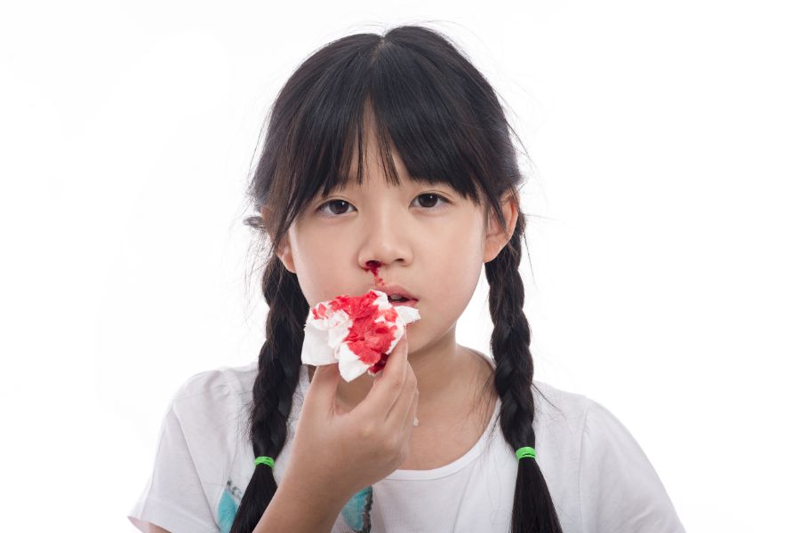 鼻骨骨折的病因揭晓