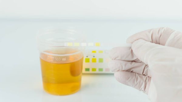 尿液有氨气味怎么回事
