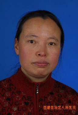 周小红